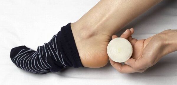 <strong>6 lucruri care se întâmplă când dormi cu o ceapă în ciorapi</strong>